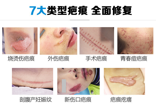 祛疤前顧慮解答！擔心沒效果？擔心費用高